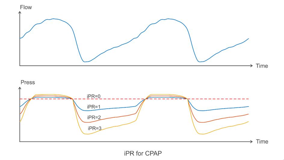 ipr for cpap